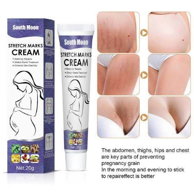 Picture of South Moon Effective Body Stretch Marks Removal Cream Lotion Pregnancy Stretch Mark Cream for Fair Skin Repair Cream 20g