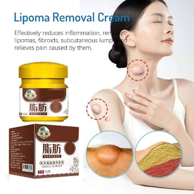 Picture of Huangfutang Lipoma Removal Cream-20gm