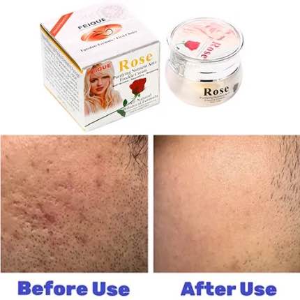 Picture of FEIQUE Rose Purifying Nutrient Anti-Freckle Cream-20gm