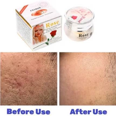 Picture of FEIQUE Rose Purifying Nutrient Anti-Freckle Cream-20gm