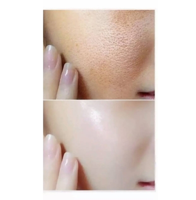 Picture of One Spring Red Pomegranate Moisturizing vitamin c Serum- 15ml