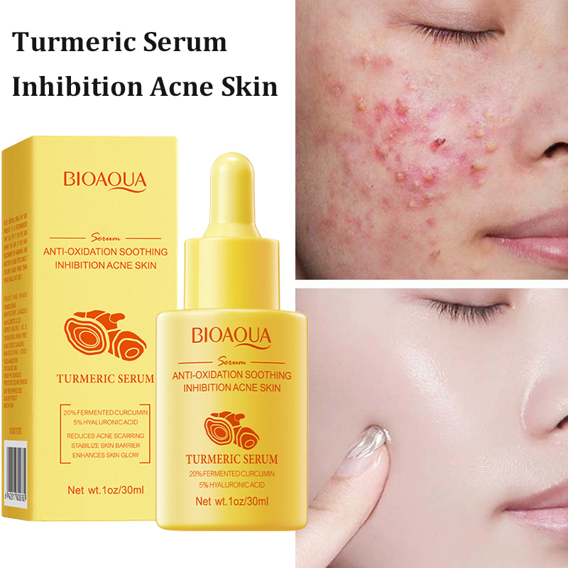Picture of BIOAQUA Anti-oxidation Soothing Acne Removal Turmeric Face Serum- 30ml