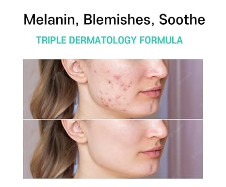 Picture of Melasma Treatment for Face Cream - Dark Spot Remover Centella Asiatica - Korean Skin Care Beauty Products 40ml/1.35 fl.oz