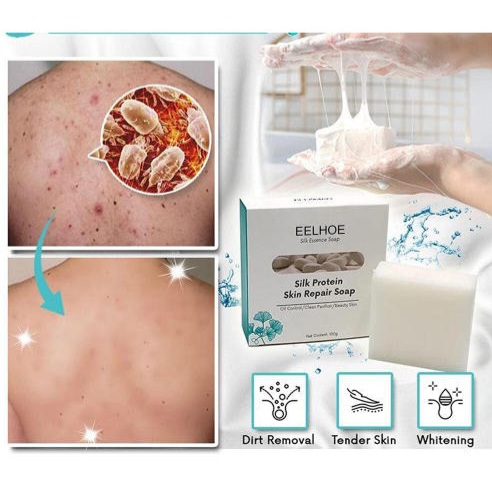 Picture of Silk Protein Skin Repair Soap 100g, Soap Acne Treatment Cool And Comfortable Face Silk Protein Skin Repair