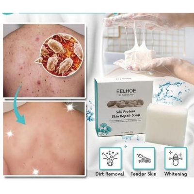Picture of Silk Protein Skin Repair Soap 100g, Soap Acne Treatment Cool And Comfortable Face Silk Protein Skin Repair