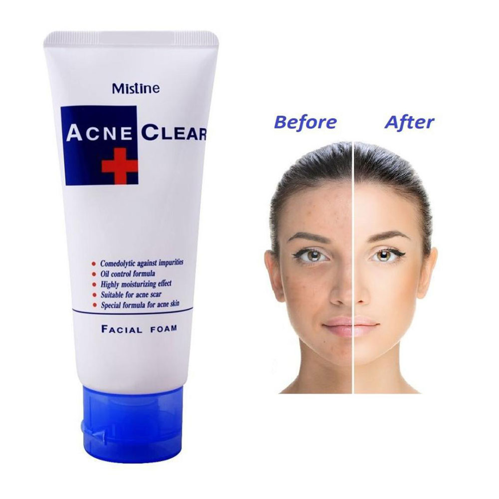 Picture of International Thailand product Skin care Mistine Acne Clear + used for male/female - 85 gm