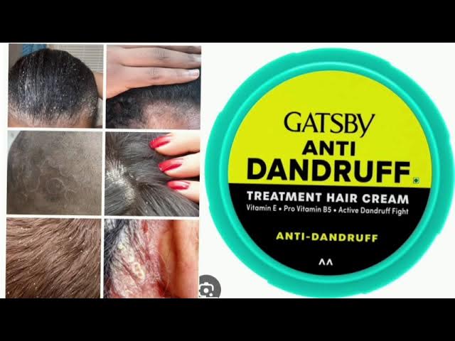 Picture of 70 gm Gatsby Anti Dandruff treatment hair cream International Indonesian product used for male