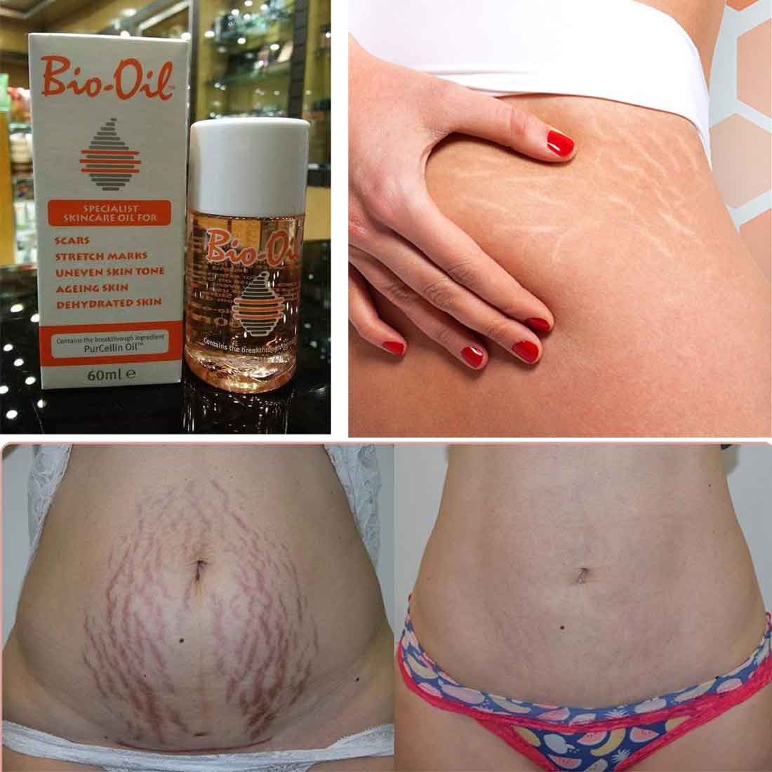 Picture of 60 ml Bio-Oil specialist skin care PurCellin oil International South African product used for male female