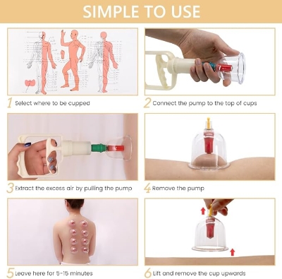 Picture of 32 Vacuum Cups Chinese Medicine  Therapy Cupping Set Acupuncture Massager hijama