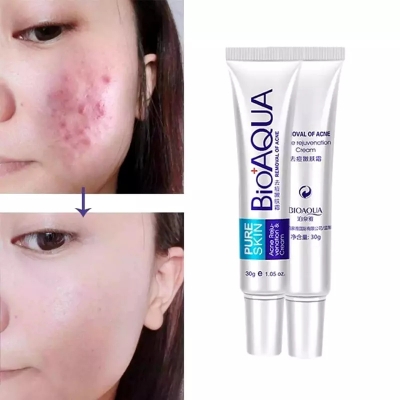Picture of BIOAQUA Pure Skin Acne Rejuvenation & Cream - 30g