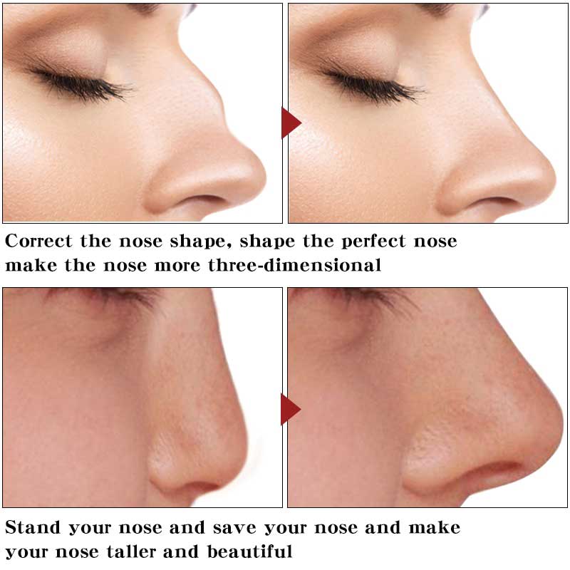 Picture of Beautiful Nose Essential Oil