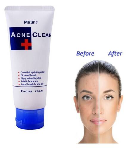 Picture of Mistine Acne Scar Clear Oil Blemish Control Facial Foam Face Wash From (Thailand)85 g
