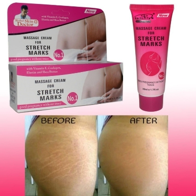 Picture of Massage cream for stretch marks Crème de massage pour les vergetures