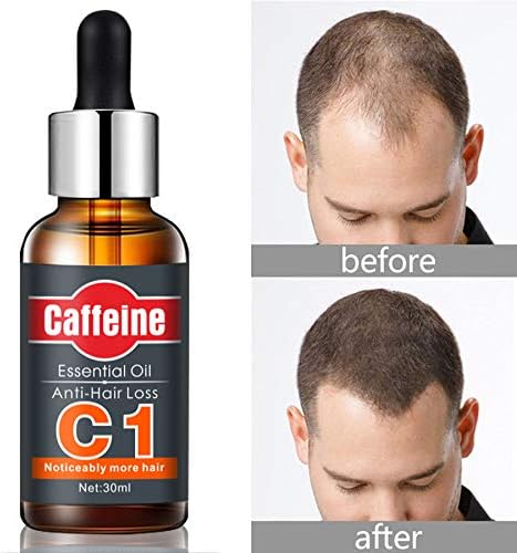 Picture of Caffeine Essential Anti-Hair Loss Oil 30 ml