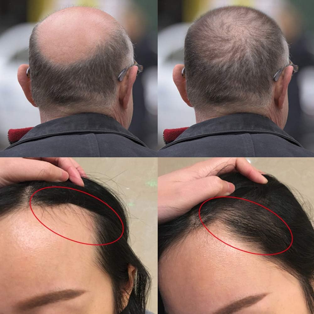 Picture of Caffeine Essential Anti-Hair Loss Oil 30 ml