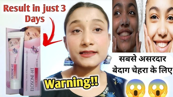 Picture of ELOSONE-HT Skin Cream - 15gm (Indian) 1 Pcs