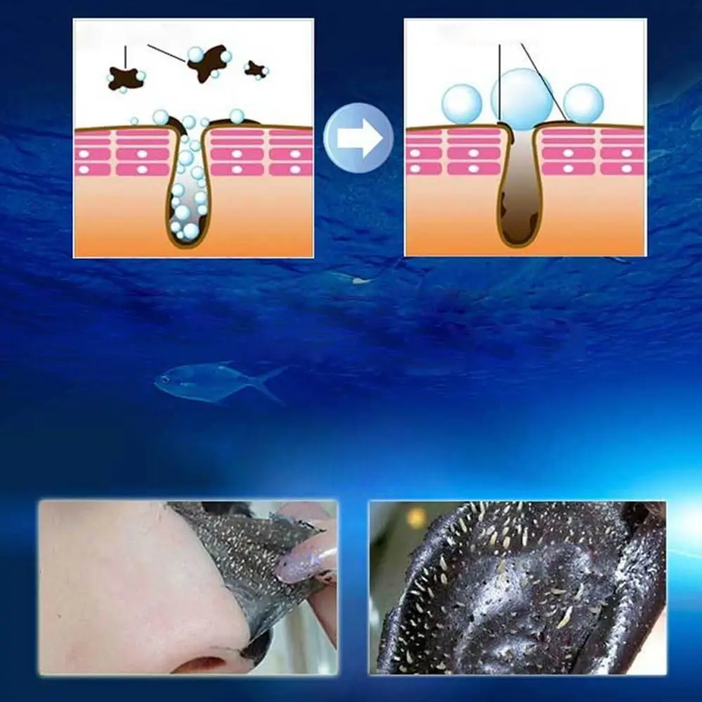 Picture of AICHUN BEAUTY Whitening Complex Black Mask Remove Blackhead Deep Cleansing Pilaten Blackhead Remover Purifying Peel Face Mask 120ml