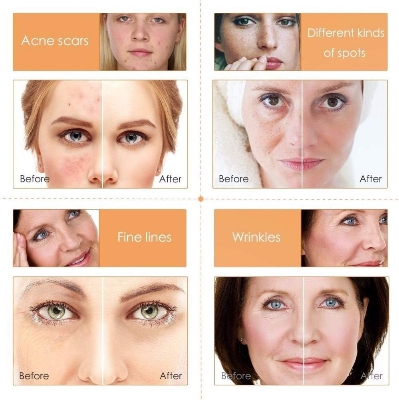 Picture of MELAO Naturals Vitamin C Facial Serum-30ml