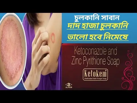 Picture of Ketokem Medicated Anti-Fungal Soap(Indian) - 75gm