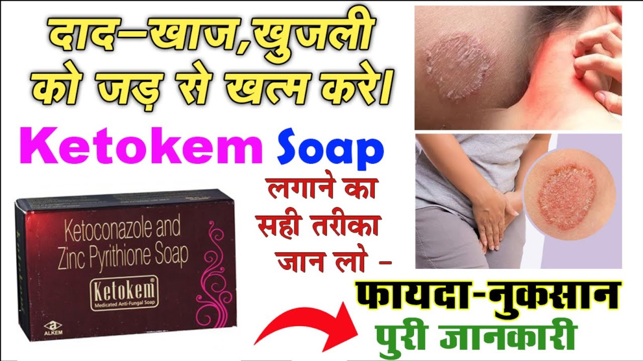 Picture of Ketokem Medicated Anti-Fungal Soap(Indian) - 75gm