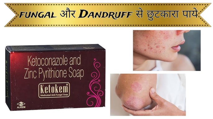 Picture of Ketokem Medicated Anti-Fungal Soap(Indian) - 75gm