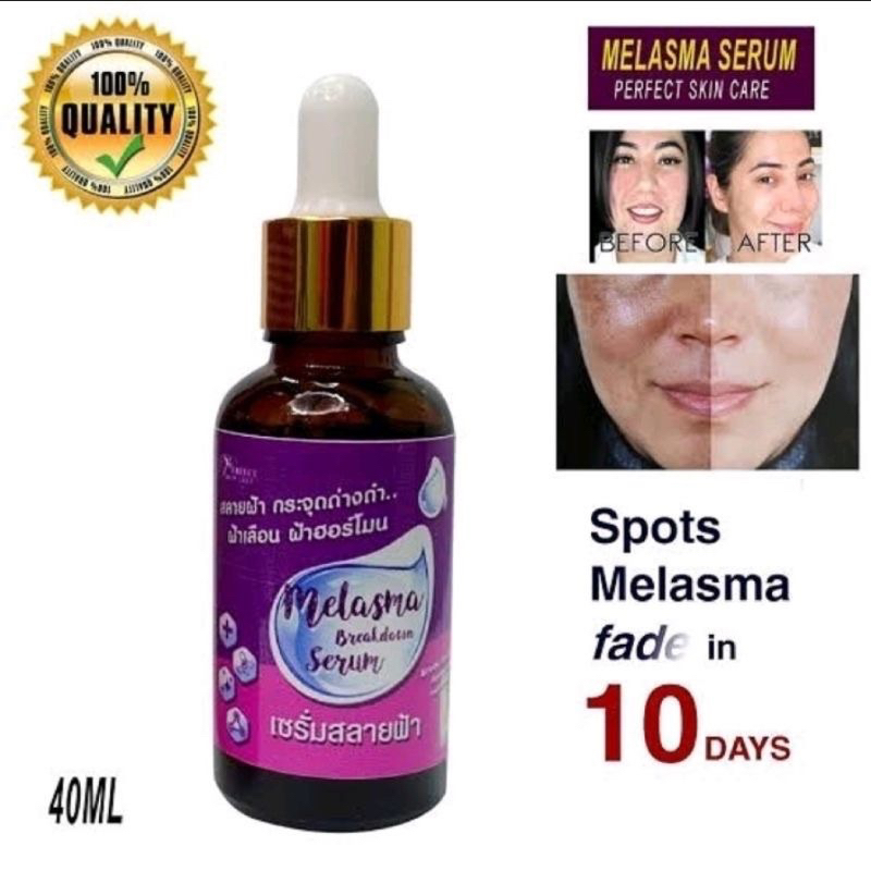 Picture of Perfect Skin Lady Melasma Breakdown Serum (40ml)