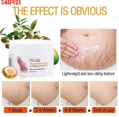 Picture of Melao Stretch Mark Cream For Pregnancy & Scar Removal 120g