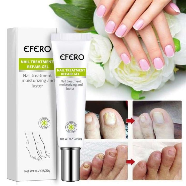 Picture of Efero Nail Repair Treatment Gel Fungus Cream-20gm