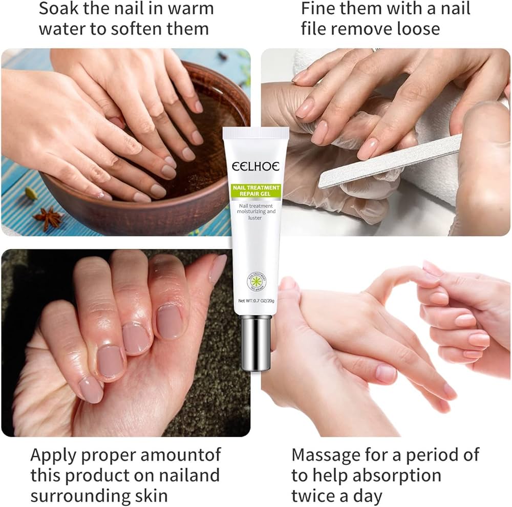 Picture of Efero Nail Repair Treatment Gel Fungus Cream-20gm