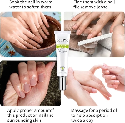 Picture of Efero Nail Repair Treatment Gel Fungus Cream-20gm