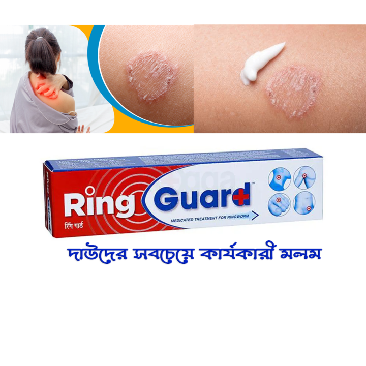 Picture of Indian Ring _Guard- 12g (Anti-fungal medicated cream)