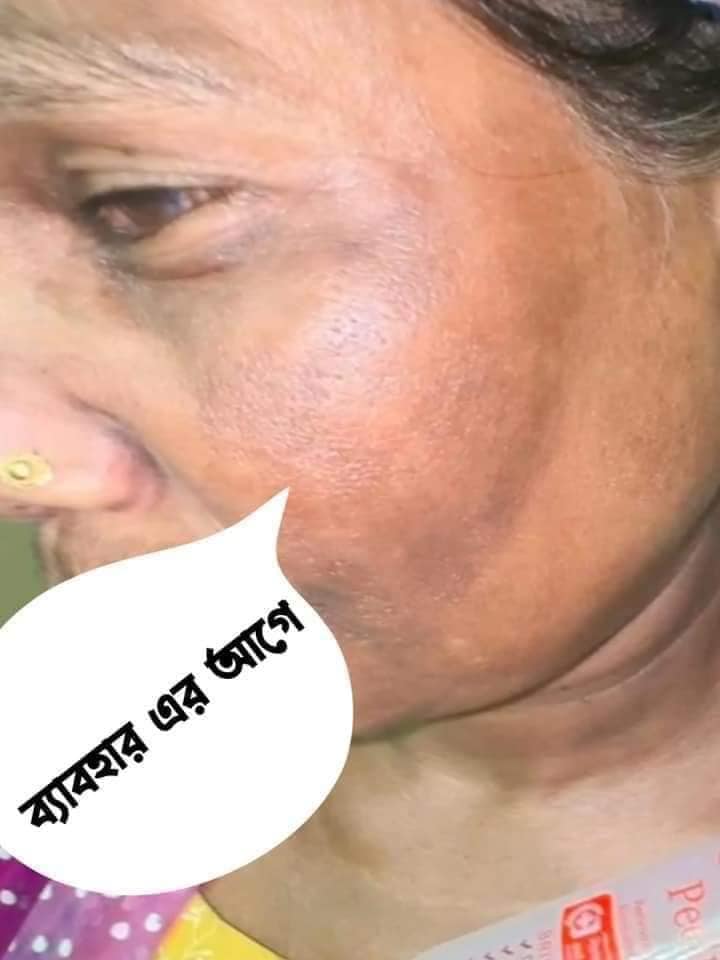 Picture of Tomato Peeling Gel | ISO Approved | 100% Authentic | Brightening Face & Body Exfoliating Gel 320 ml