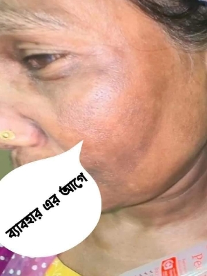 Picture of Tomato Peeling Gel | ISO Approved | 100% Authentic | Brightening Face & Body Exfoliating Gel 320 ml