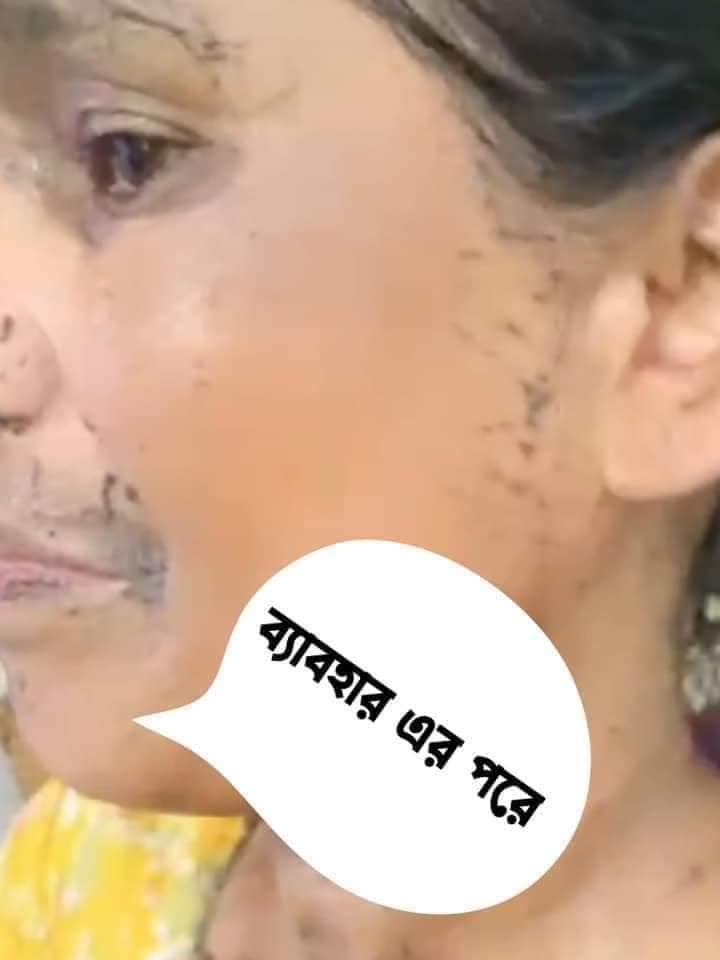 Picture of Tomato Peeling Gel | ISO Approved | 100% Authentic | Brightening Face & Body Exfoliating Gel 320 ml