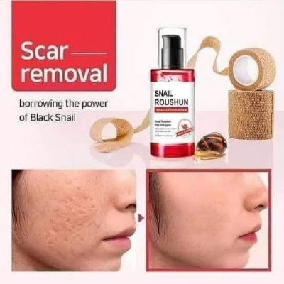 Picture of Snail ROUSHUN Miracle Repair Serum- 50ml