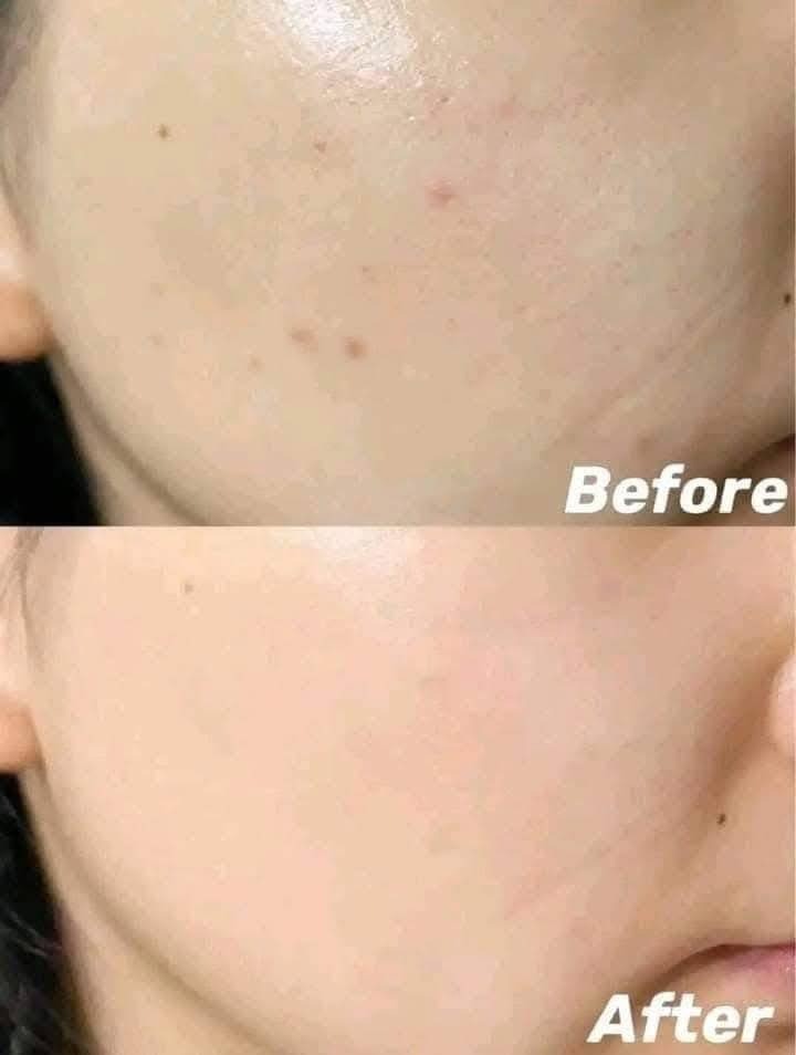 Picture of Fiorae Ultra White With Gluta X3 Soap-165gm (Thailand )