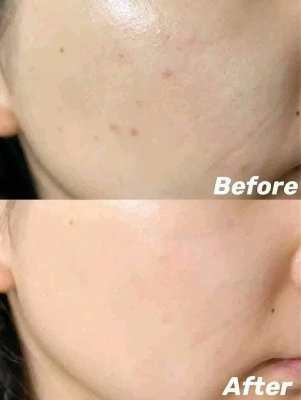 Picture of Fiorae Ultra White With Gluta X3 Soap-165gm (Thailand )