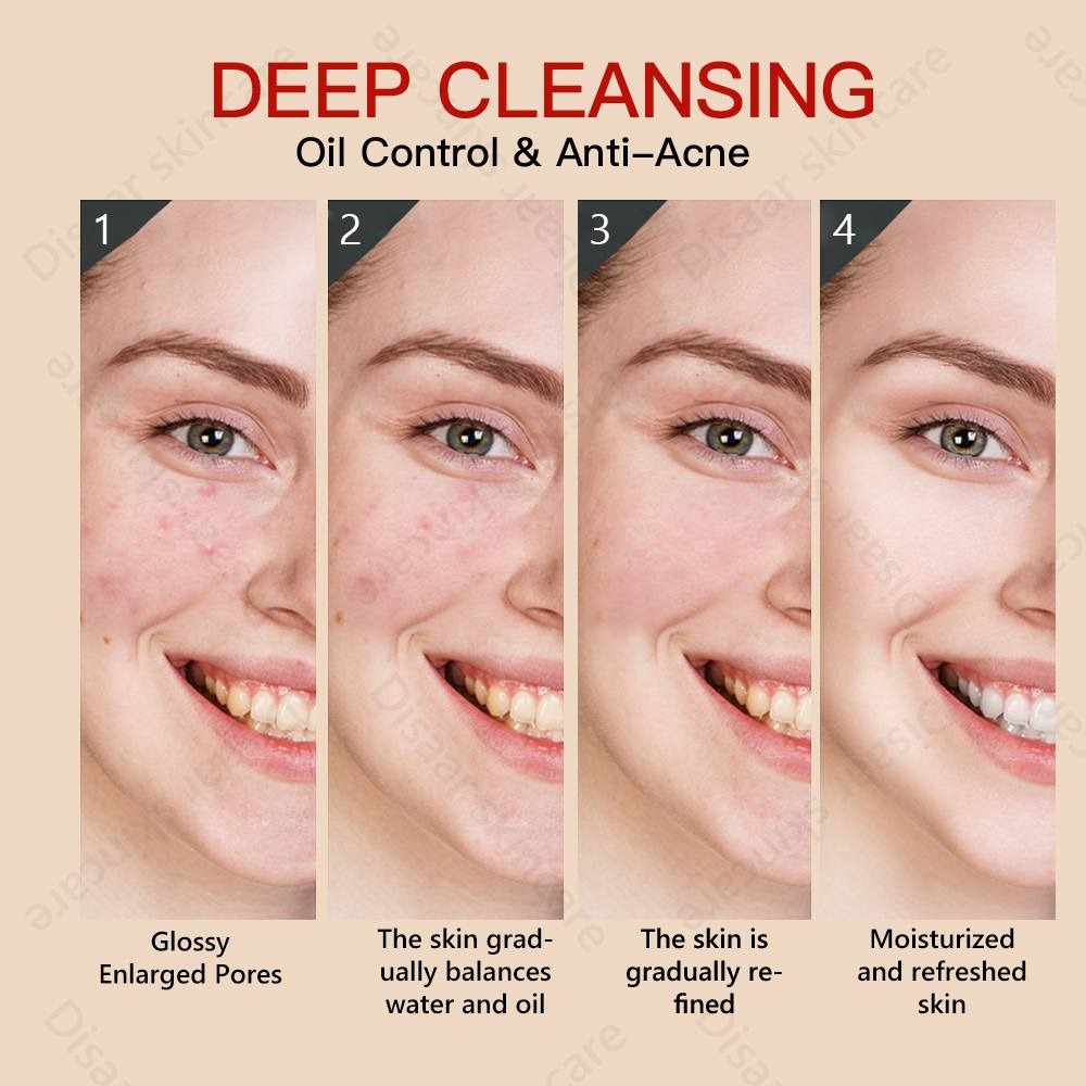 Picture of Guanjing Kojic Acid Facial wash with Deeply Cleansing Anti-Acne Cleanser 100g