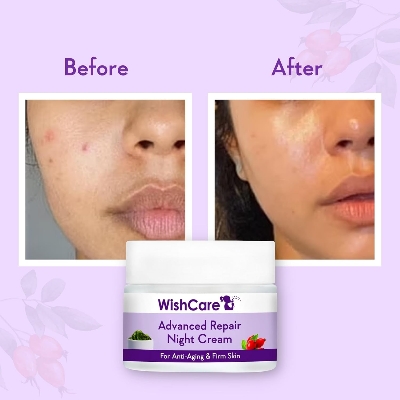 Picture of WishCare Collagen Boosting - Advance Repair Night Cream - With Retinol, Niacinamide, GrapeSeed, Sea Algae, Jojoba & Rosehip - For Anti-Aging, Skin Firming & Plumping Skin - 50 gm