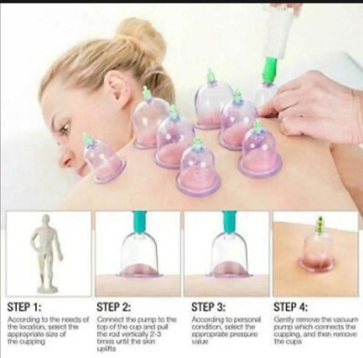 Picture of Hijama cupping Sunnah therapy 12psc set
