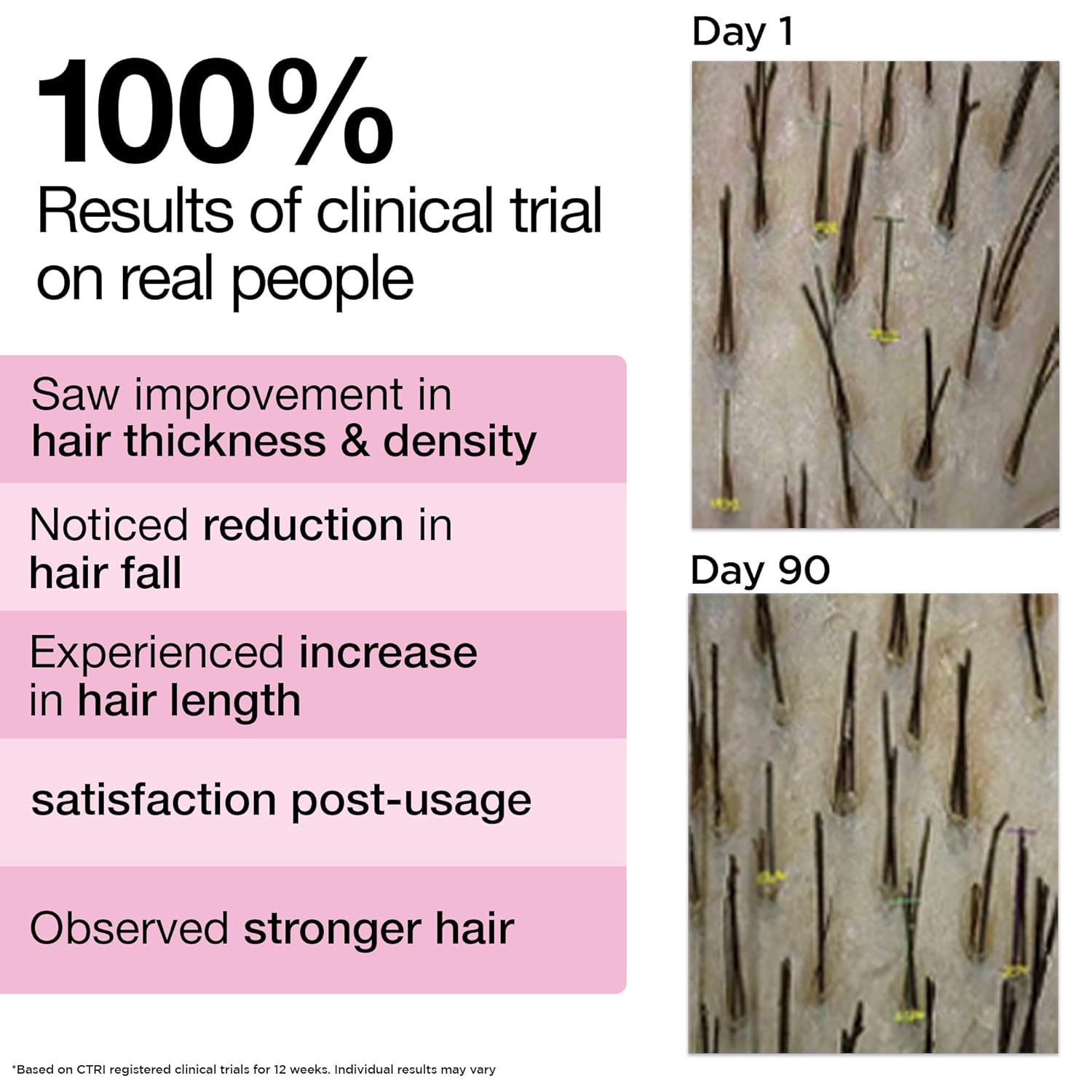 Picture of Soulflower Rosemary Lavender Hair Oil For Hair Growth, Hair Fall Control, Healthy Scalp, Long Hair, Rosemary, Lavender, Castor|100% Pure, Natural, Organic, Clinically Proven for Hair Growth, 120ml