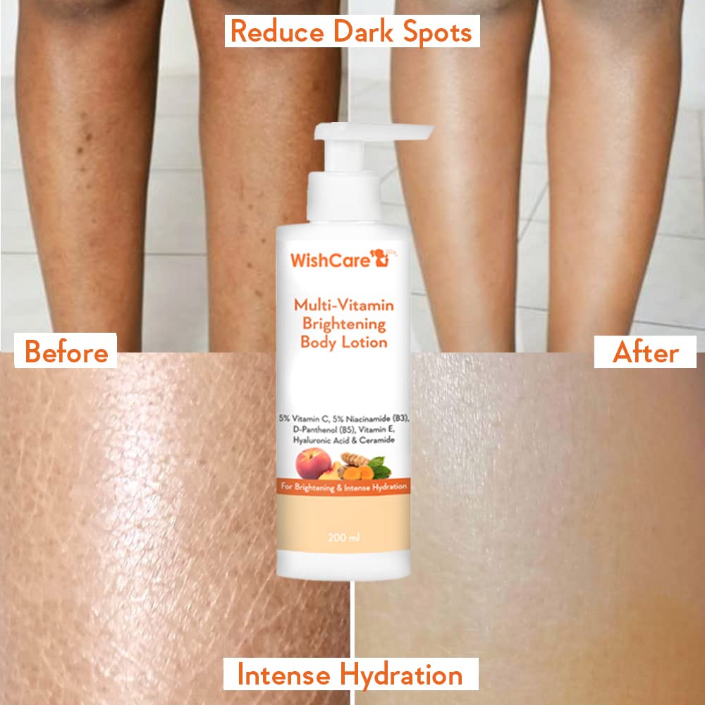 Picture of WishCare Multi-Vitamin Brightening Body Lotion - 5% Vitamin C, 5% Niacinamide(B3), Panthenol(B5), Vitamin E, Turmeric & Kakadu Plum - For Men & Women - 200 Ml