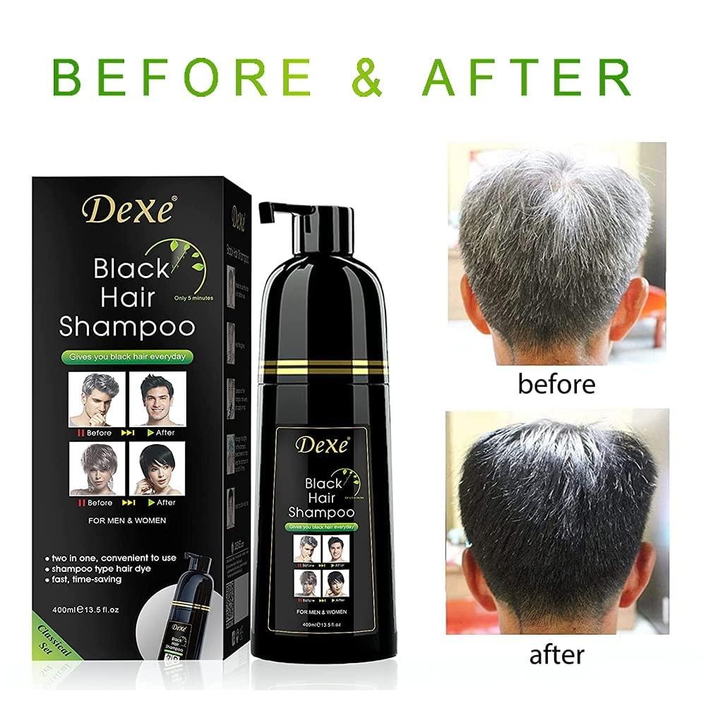 Picture of 400 ml Dexe Black hair shampoo International USA product used for male female
