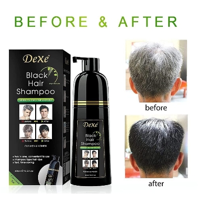 Picture of 400 ml Dexe Black hair shampoo International USA product used for male female