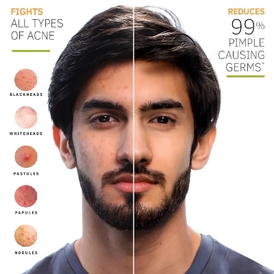 Picture of 50 gm Mankind Acne Star face wash Indian product used for male female