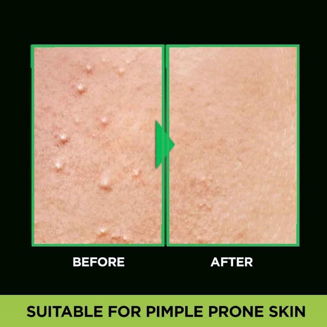 Picture of 100 ml Garnier Men Acno Fight Anti-Pimple face wash Indian product