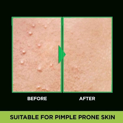 Picture of 100 ml Garnier Men Acno Fight Anti-Pimple face wash Indian product