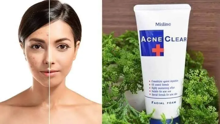 Picture of International Thailand product Acne Clear Plus Facial Foam used For male/female 85 Gm