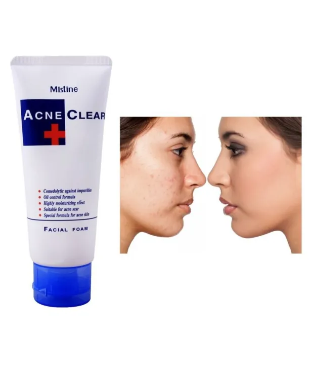 Picture of International Thailand product Acne Clear Plus Facial Foam used For male/female 85 Gm