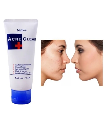 Picture of International Thailand product Acne Clear Plus Facial Foam used For male/female 85 Gm